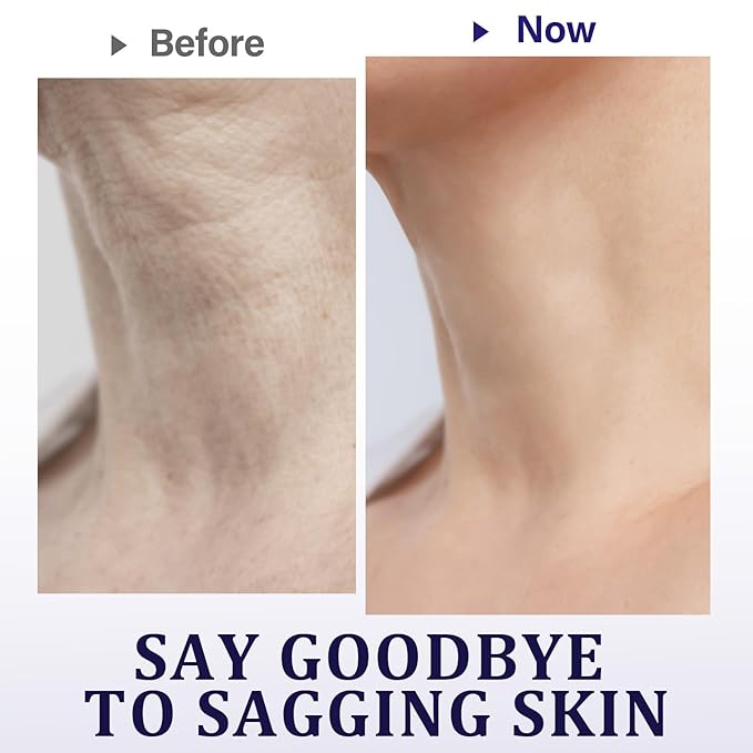 Neck Wrinkle Patches, 5PCS Anti Wrinkle Neck Tapes Improve Fine Lines, Firm and Moisturize and Tighten Sagging skin, Collagen Neck Lift Mask