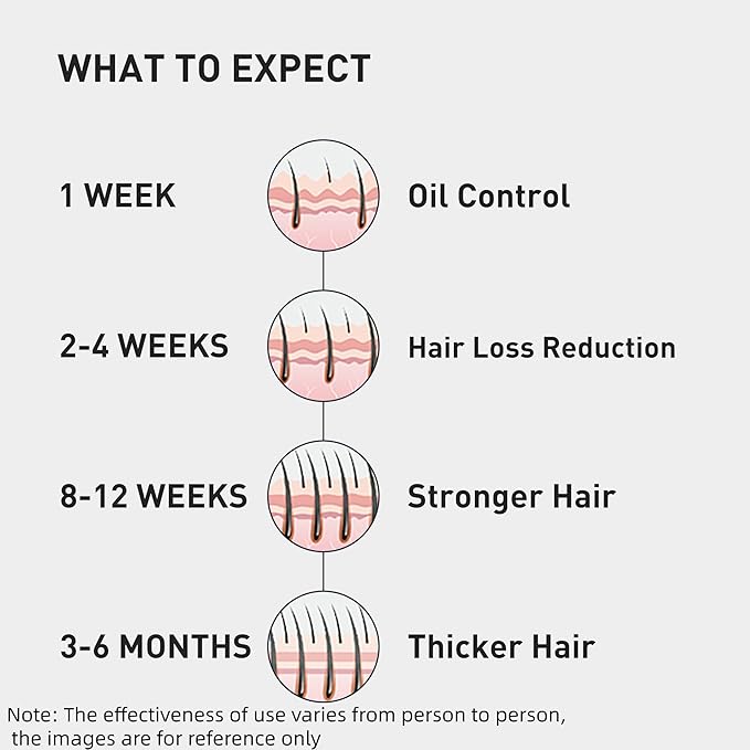 KINTOR 0.9% KX-826 Hair Regrowth Spray,Supporting Healthy Hair Growth,Oil Control, Hair Growth Products Group for Men&Women,Pro,60ml