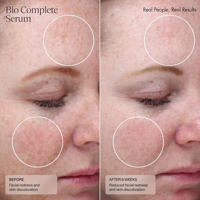 Senté Bio Complete Serum | Retinoid Serum for Sensitive Skin | Gentle, Nourishing & Hydrating | Combats Dull and Aging Skin | 1.0 Fl Oz