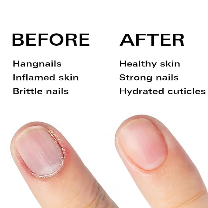 Nail Oil Cuticle Pen - Lemon - Nail Strengthener & Growth Serum with Vitamin A, D, E, B5, Grapeseed & Natural Oils - Repair for Brittle, Peeling, Thin Nails - Twist Brush Pen