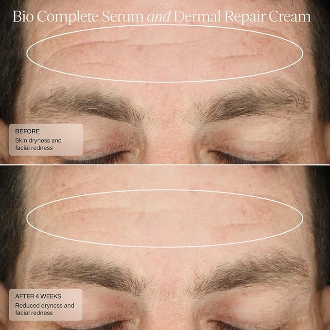 Senté Bio Complete Serum | Retinoid Serum for Sensitive Skin | Gentle, Nourishing & Hydrating | Combats Dull and Aging Skin | 1.0 Fl Oz