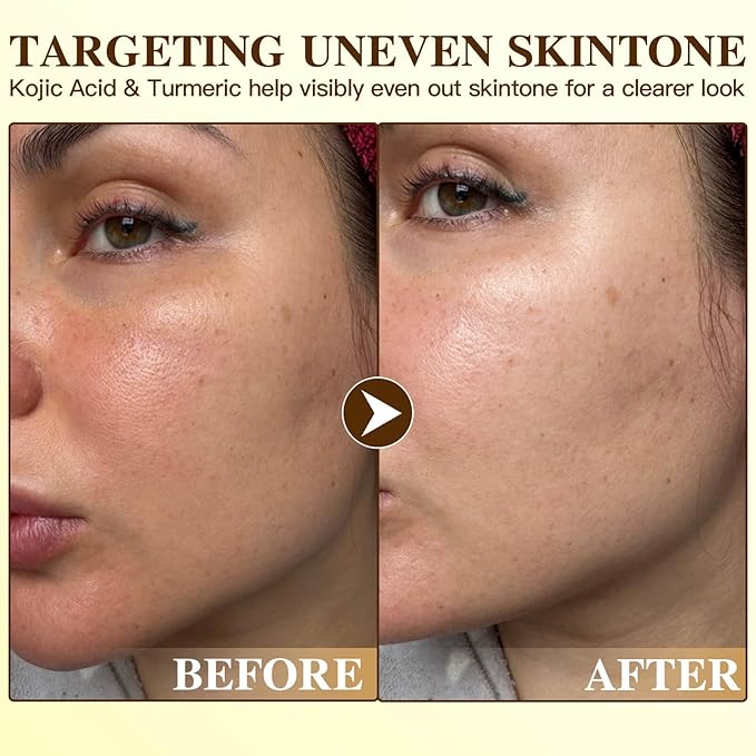 Radiance Turmeric Collagen Face Mask, 5 Pack - Overnight Calming Ance Mask with Kojic Acid for Roughed Skin & Dullness, Oil Control & Pore Refining Facial Sheet Mask