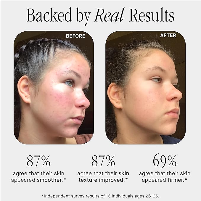 Brandefy No Needles - Niacinamide Serum, Peptides and Hyaluronic Acid. Hydrating & Plumping Serum for Bright, Smooth, Firm & Dewy Skin, 1oz, Made In The US