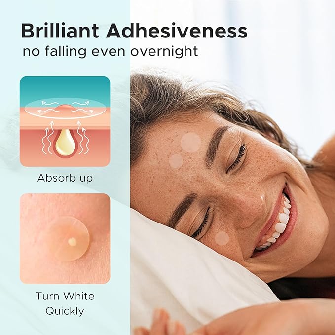 TKTK Pimple Patch Acne Patch, 4 Sizes 420 Patches Acne Absorbing Cover Patch, Hydrocolloid Invisible Acne Patches For Face Zit Patch Acne Dots Tea Tree, Calendula Oil - 3 Pack