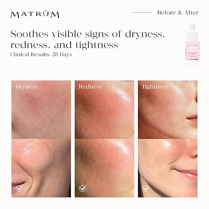 Mini Face Serum Duo | Travel-Size Set – 2 x Mini Serums for Soothing, Barrier Repair, Firming & Brightening | For All Skin Types