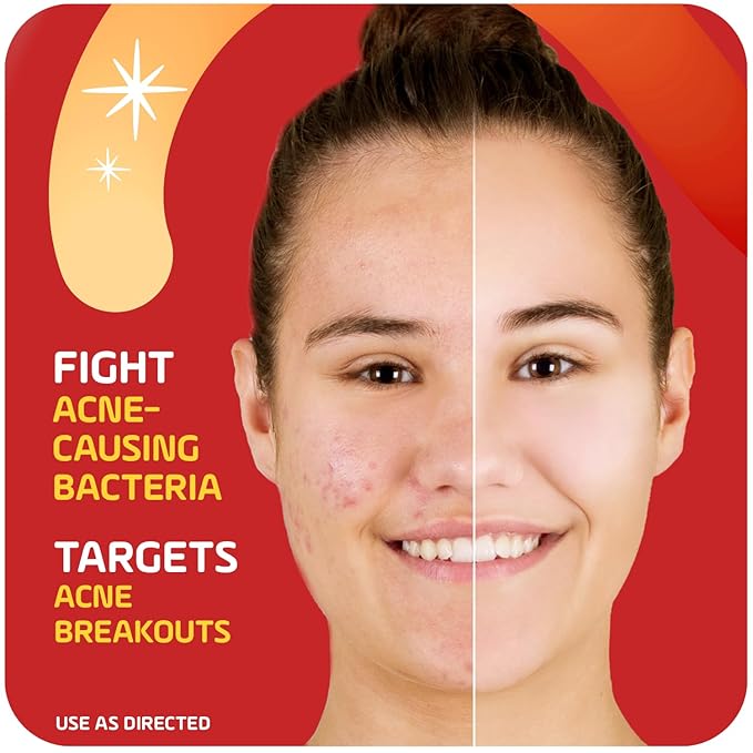 Asepxia 2% Salicylic Acid Acne Spot Treatment Cream | Drying Formula Targets Acne, Clears & Prevents Blemishes, Reduces Redness, Penetrates Pores, Pimple Cream, 1 Oz, 3-Pack