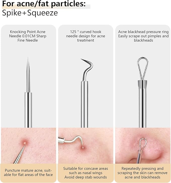 9 - Piece Stainless Steel Acne Tool Set - Complete Kit with Ultra - Sharp Tweezers, Needles for Effective Blackhead & Acne Removal