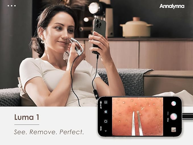 Luma 1 Visual Black Head Remover Tweezers with Camera - Pimple Popper Tweezers with Camera 20x Magnification, 1080P, 8 LED Lights, Dolphin Design Non-Magnetic Tweezers, Pore Cleaner