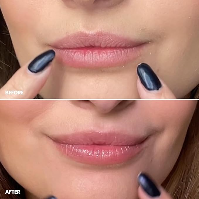 Wonderskin 3-in-1 Lip Scrub Exfoliator & Moisturizer, Lip Exfoliator Scrub, Hydrating Balm for Soft, Nourished, Flake-Free Lips with One-Step Prep, 0.10oz