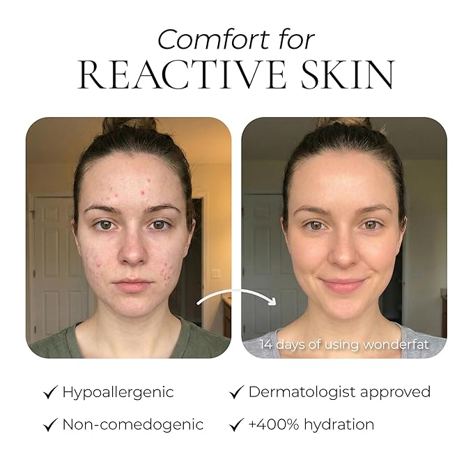 Grass-Fed Whipped Tallow Balm – Face & Body Moisturizer with Manuka Honey – Lightweight, Fast-Absorbing Hydration for Dry, Sensitive Skin – Unscented, Clean Formula – 3 oz