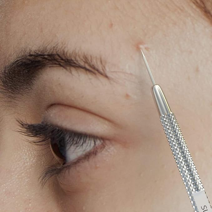 Suvorna Pimple Popper Tool Kit | Milia Remover | Lancets for Facial Extraction | White head Extractor Tool for Face | Comedone Extractor | Blackhead Remover tool | Acne Needle Tool & Cyst Removal Tool