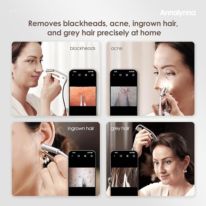 Luma 1 Visual Black Head Remover Tweezers with Camera - Pimple Popper Tweezers with Camera 20x Magnification, 1080P, 8 LED Lights, Dolphin Design Non-Magnetic Tweezers, Pore Cleaner