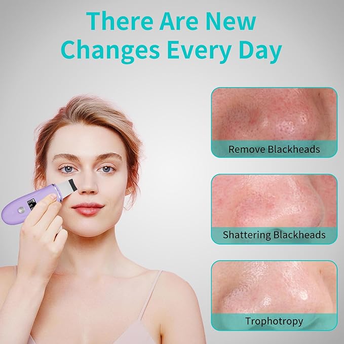 Face Scrubber Skin Spatula - Blackhead Remover Deep Cleansing Tool for Pore Extraction, 4-in-1 Fast Charging Dock Blackhead Remover Face Spatula for Facial Skincare Women Gift (Purple)