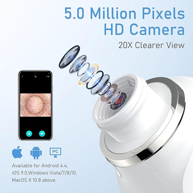 Facial Pore Blackhead Remover Vacuum, 1080P Camera Blackhead Remover, 20x Zoom, 8 LEDs ＆ 3 Suction Modes, 800mAh Battery & USB - 6 Heads Pore Cleaner Kit for Women&Men(White)