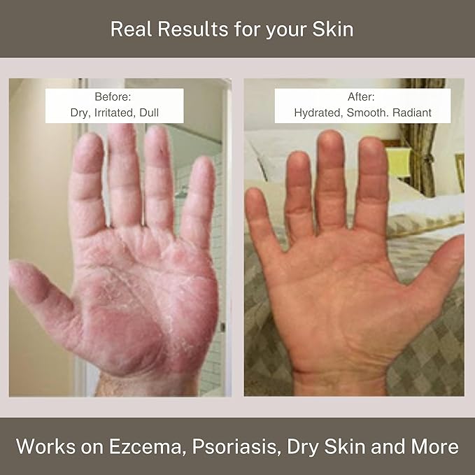 InfiniteAloe Complete Skin Care, Aloe Vera Powered Face and Body Cream for Dry Skin Relief, Fragrance Free - Small Jar 2 oz