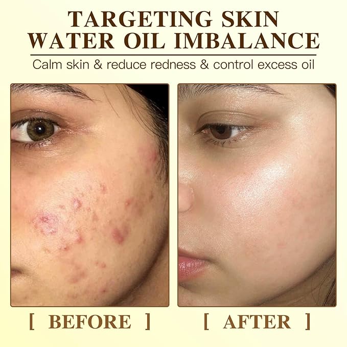 Radiance Turmeric Collagen Face Mask, 5 Pack - Overnight Calming Ance Mask with Kojic Acid for Roughed Skin & Dullness, Oil Control & Pore Refining Facial Sheet Mask