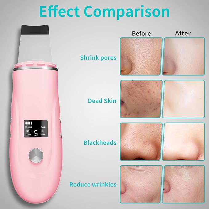 Face Scrubber Skin Spatula - Blackhead Remover Deep Cleansing Tool for Pore Extraction, 4-in-1 Fast Charging Dock Blackhead Remover Face Spatula for Facial Skincare Women Gift (Pink)