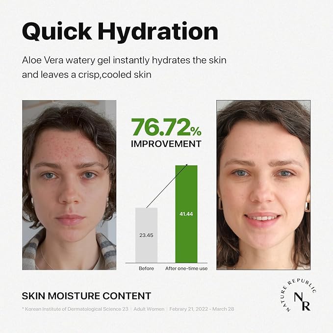 Nature Republic MILD & MOISTURE ALOE VERA WATERY GEL (1 PCS) Quick Hydration & Moisturizing,fast absorbing non-sticky texture,korean skin care for Face,Hair,Sunburn relief, aftershave, all Skin Types