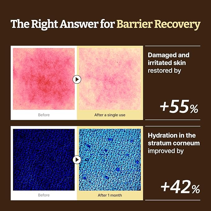 Dr. Reju-All Advanced LC-Ceramide Barrier Cream - Patented Long Chain Ceramide Deep Hydration - Lightweight Korean Face Moisturizer for Strengthening Skin Barrier - 1.69 Fl Oz