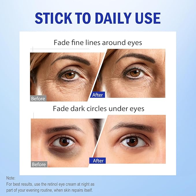 Retinol Eye Cream, Hydrating Under Eye Care Daily Wrinkle Cream, Infused with AHA30% to Smooth and Hydrate Skin, Eye Crea for Dark Circles Treatments, Reduce Under Eye Bags, Smooth Wrinkles