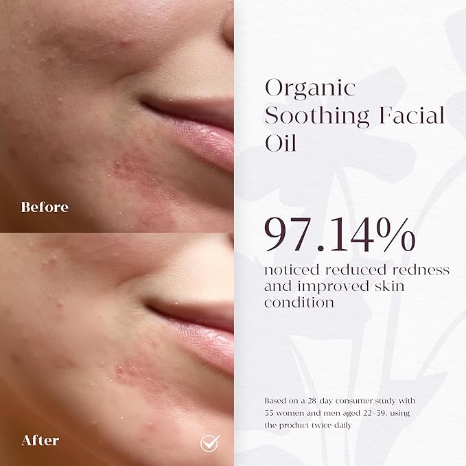 Barrier Repair Serum with Borage Oil – Face Serum for Dry & Sensitive Skin | Hydrates, Soothes Redness & Dryness | Brightens Dull Skin | Suitable for All Skin Types | 1.0 fl oz + Travel Size