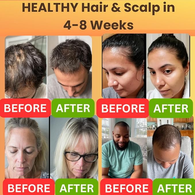 REVATOLOGY Hair Growth Oil for Adults (Made in USA) pre-rinse Formula with 30 Oils and Herbal extracts Reduces Hair Fall, Boosts Regrowth & Strengthens Roots | Cruelty & Chemical Free