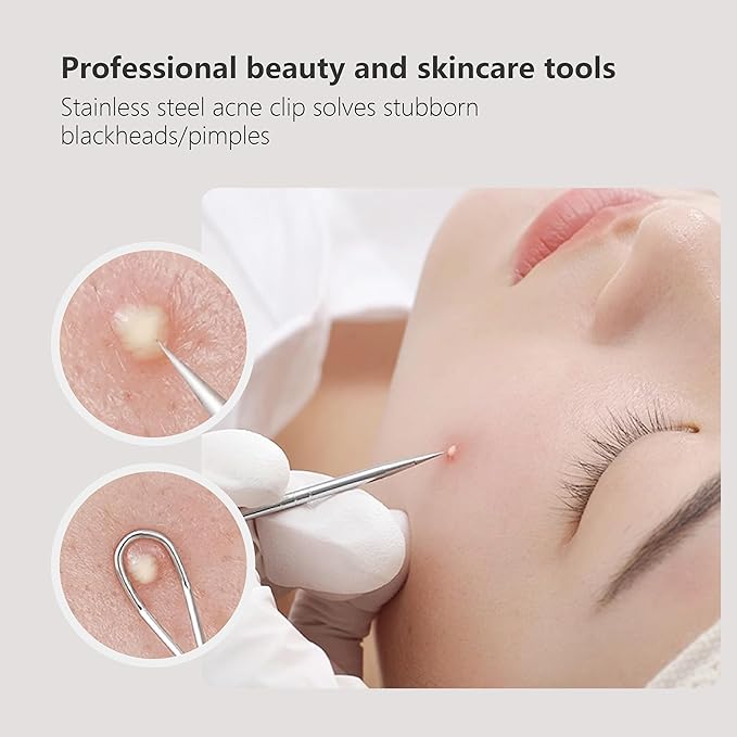 9 - Piece Stainless Steel Acne Tool Set - Complete Kit with Ultra - Sharp Tweezers, Needles for Effective Blackhead & Acne Removal