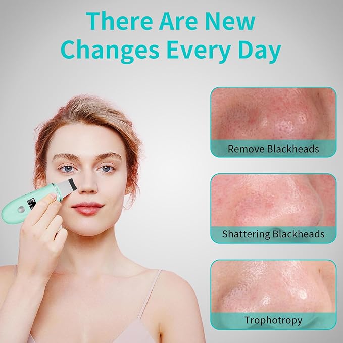 Face Scrubber Skin Spatula - Blackhead Remover Deep Cleansing Tool for Pore Extraction, 4-in-1 Fast Charging Dock Blackhead Remover Face Spatula for Facial Skincare Women Gift (Green)