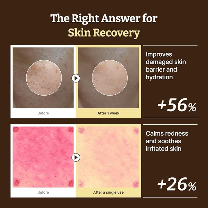 Dr. Reju-All Advanced PDRN Rejuvenating Cream Max – 99% Pure Salmon DNA PDRN Face Moisturizer – Optimal 1200ppm Concentration for Glow Skin – Korean Anti-Aging Skin Care Face Cream - Large 2.0 Fl Oz