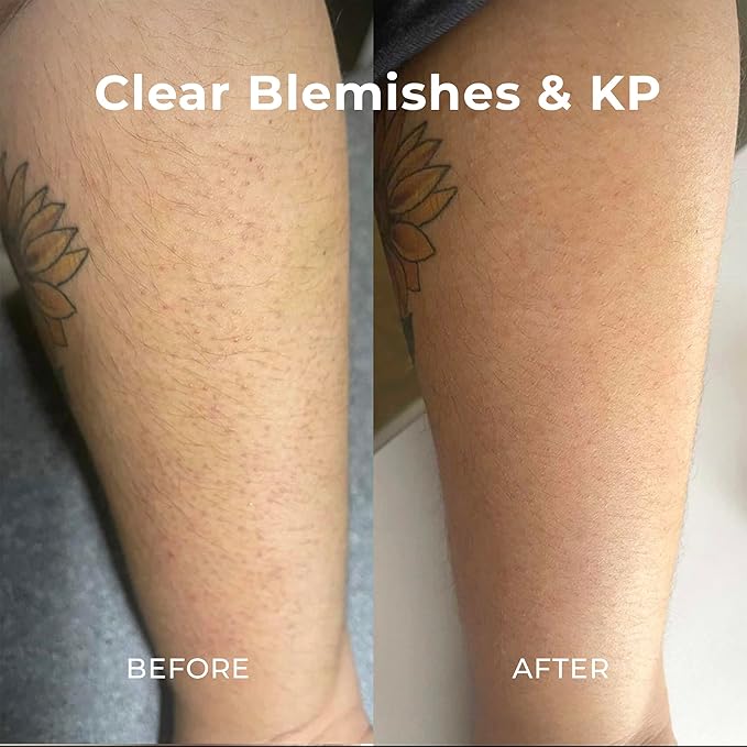 Miami Beach Bum Bum + Body Cream Orange, Oregano Bum Bum Cream For Body Acne & Razor Bumps, pH-Balanced Moisturizer, 3.4 oz