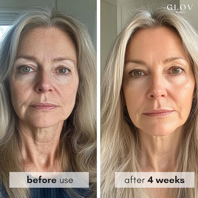 Glov Beauty Face Moisturizer with Squalane & Niacinamide - Anti Aging Hydrating Face Cream for All Skin Types, Daily Moisturizer Face Cream for Women