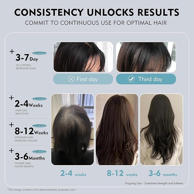 KINTOR 0.5% KX-826 DHT Blocker Hair Regrowth Spray for Men & Women 60ml