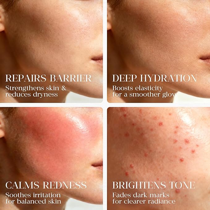 Barrier Repair Serum with Borage Oil – Face Serum for Dry & Sensitive Skin | Hydrates, Soothes Redness & Dryness | Brightens Dull Skin | Suitable for All Skin Types | 1.0 fl oz + Travel Size