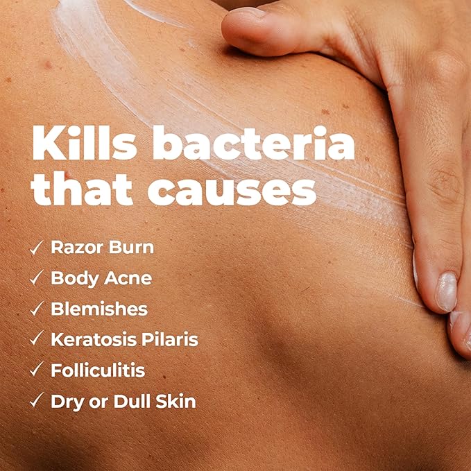 Miami Beach Bum, Bum + Body Cream Mint 6.7oz, Daily Moisturizer For Total Skin Health, Body Acne Treatment, Razor Bumps, Keratosis Pilaris, Ingrown Hairs, Sunburns, Blemishes & More..