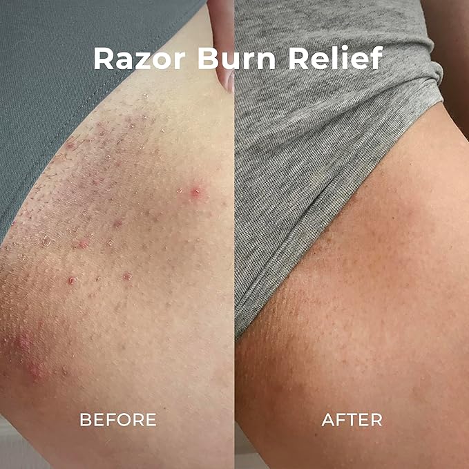 Miami Beach Bum Bum + Body Cream Orange, Oregano Bum Bum Cream For Body Acne & Razor Bumps, pH-Balanced Moisturizer, 3.4 oz