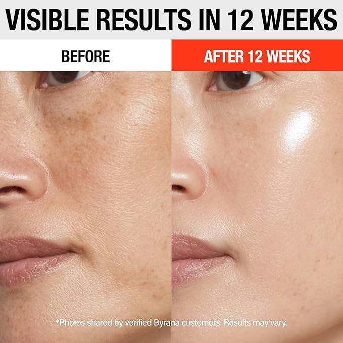 Vitamin C Brilliant Glow Face Serum – Korean Anti Aging Skincare with THD Ascorbate, Matrixyl 3000, Ferulic Acid & Ginseng – Visibly Reduces Dark Spots, Uneven Tone, Fine Lines & Wrinkles