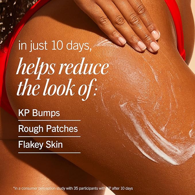 First Aid Beauty - KP Smoothing + Brightening Body Lotion with 10% AHA, Lactic Acid, Urea + Colloidal Oatmeal, Exfoliate & Moisturize, Banish Keratosis Pilaris Bumps, NEW Peach Scent (6. 7 fl oz)