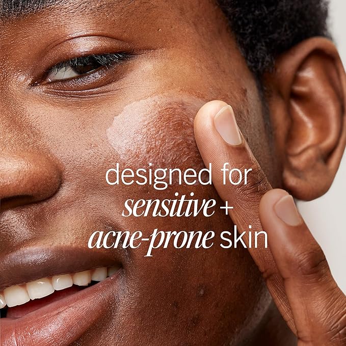 First Aid Beauty Lactic Acid Lotion for Acne-Prone Skin with 2% Niacinamide - Resurfacing Lotion Moisturizes & Visibly Diminishes Post-Acne Marks, (1.0 oz)